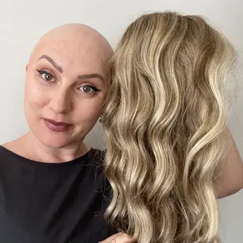 Alopecia patient wig